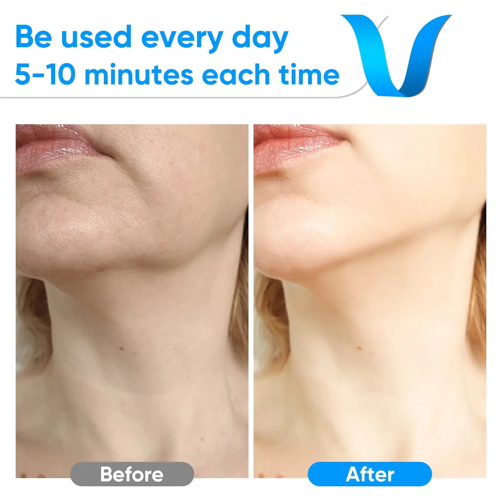 Neck Beauty Device for Skin Care Adults Men and Women White