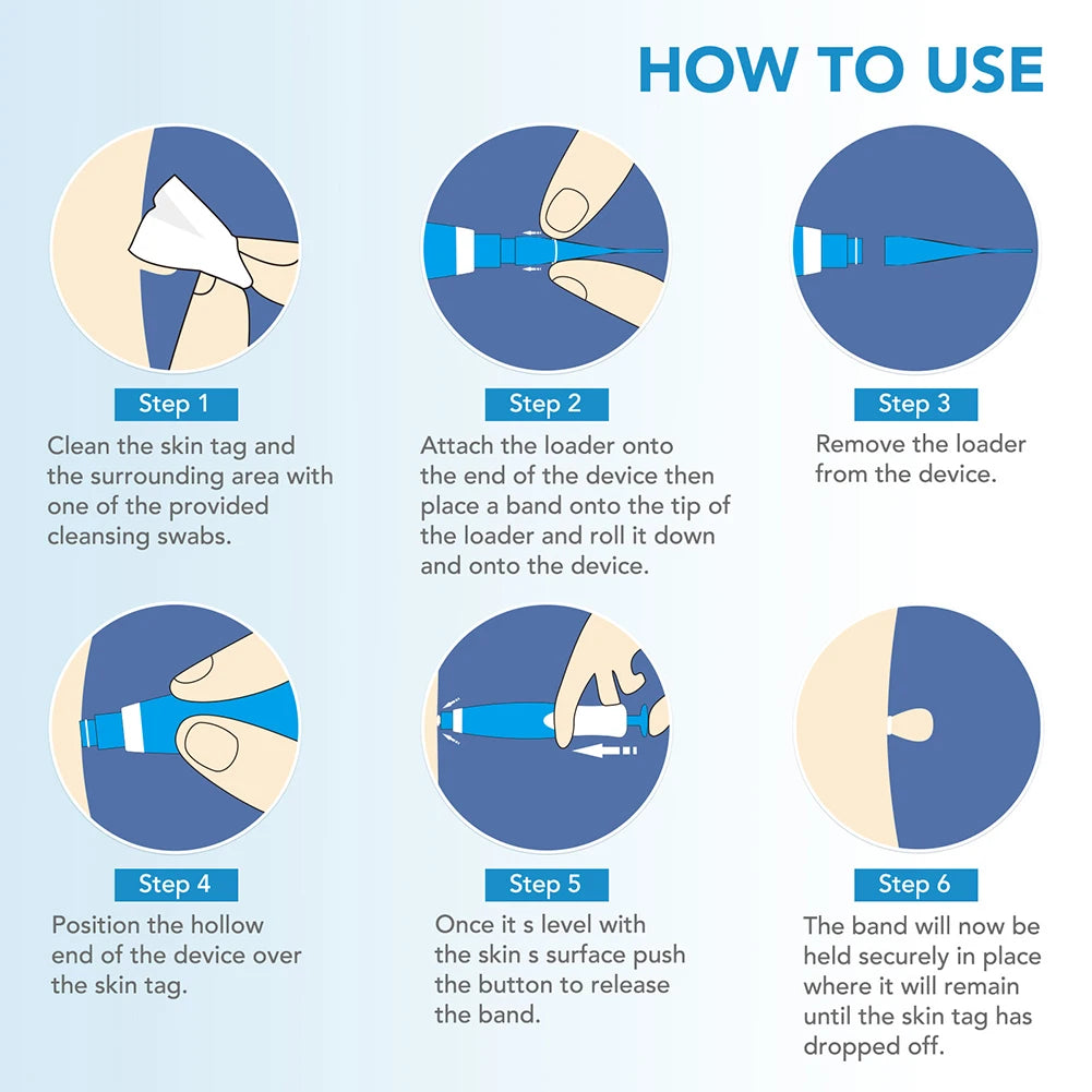 Rubber Rings Face Mole Removal Tool Kits Safety Painless